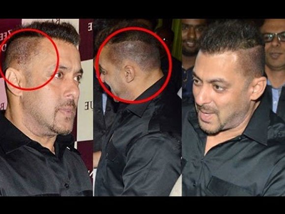 Salman Khan pictures before Hair Surgery