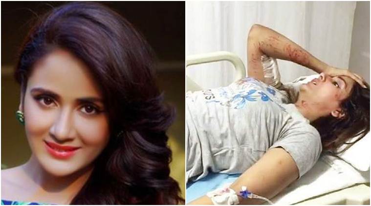 Indian Actress Parul Yadav under Dogs Attack