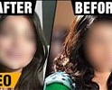 Actress’s First Appearance after Plastic Surgery