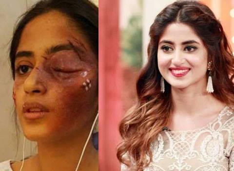 What Happened To Sajal Ali ?